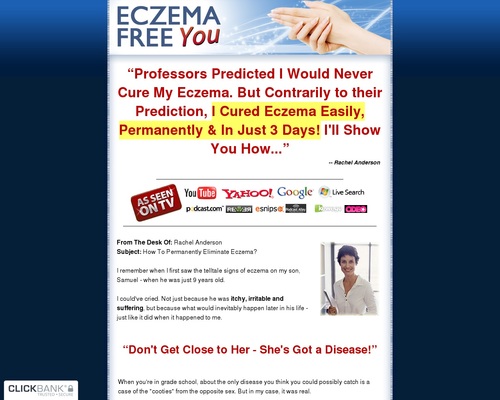 Eczema Free You – How to Treat Eczema Easily, Naturally and For Good Eczema Free You – How to Treat Eczema Easily, Naturally and For Good