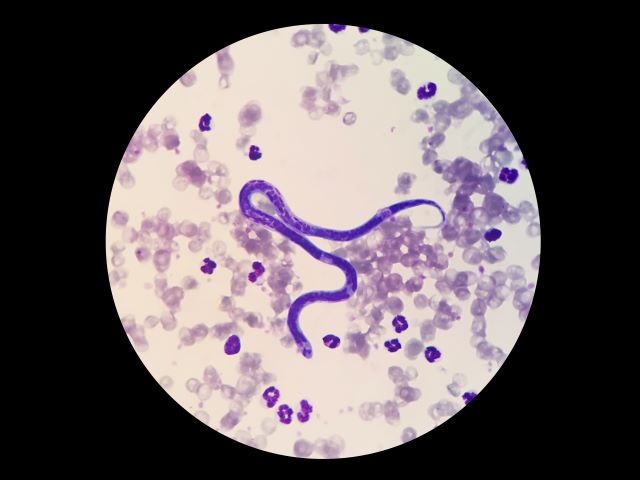 Heartworm Disease In Dogs: Everything You Need To Know Heartworm Disease In Dogs: Everything You Need To Know